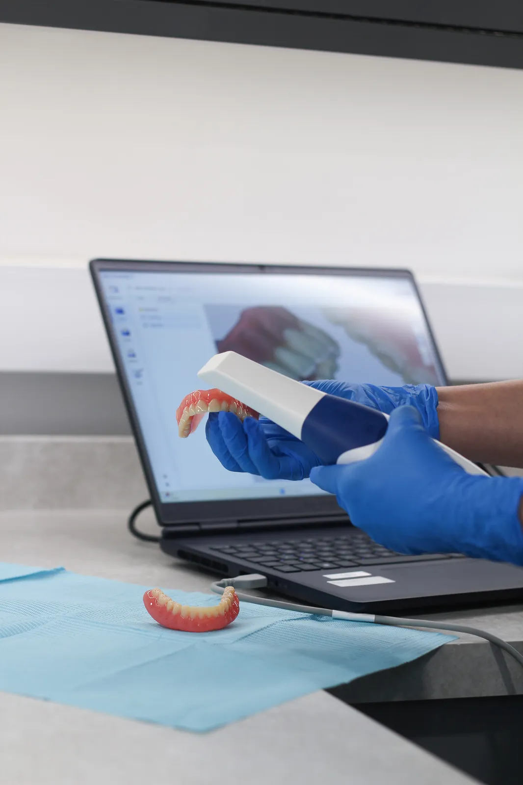 A clinician scanning a denture